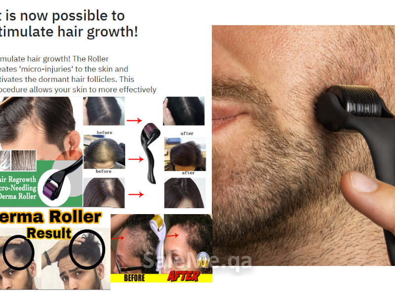 DERMA ROLLER NEW HAIR GROWTH TECHNIQUE - Al Hilal, Doha - Largest online  marketplace for buying and selling in Qatar